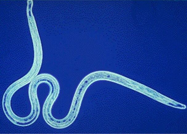 roundworms in the human body