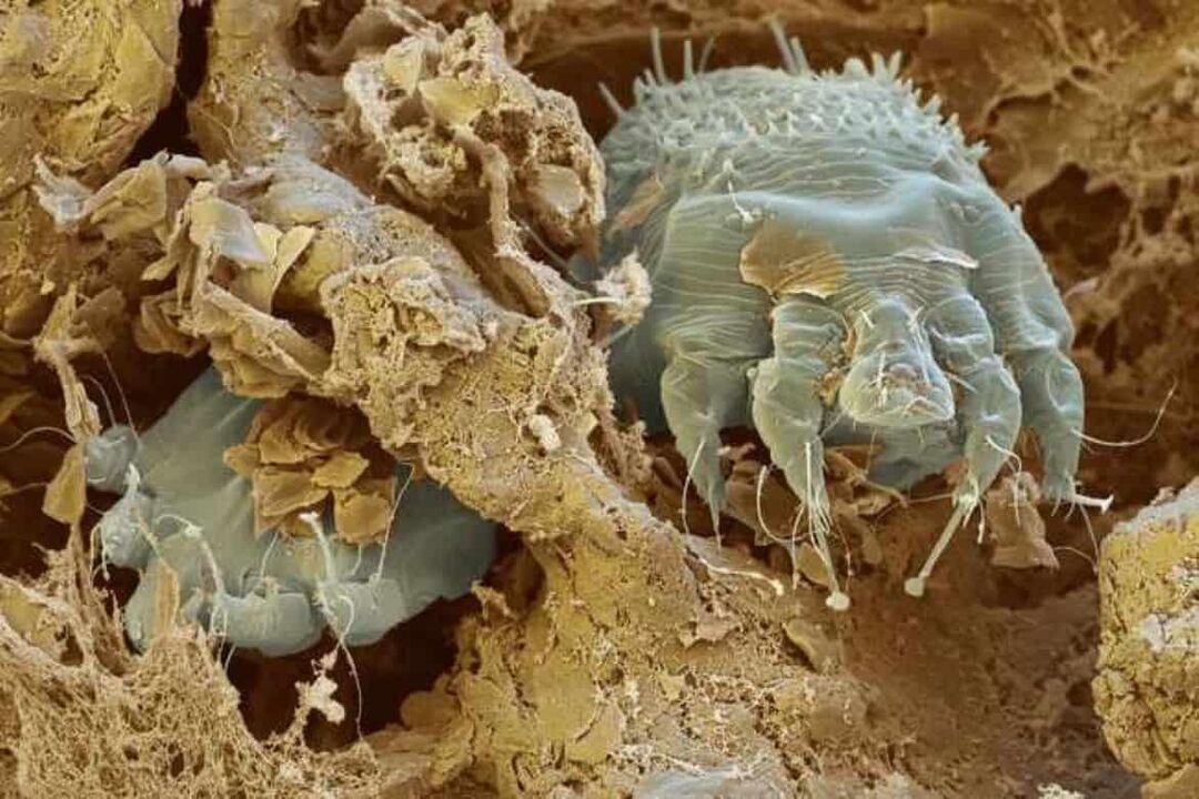scabies mite under the microscope